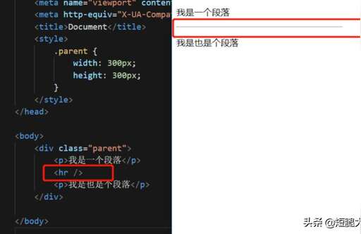 靜脈css,靜脈和動脈用字母怎么表示